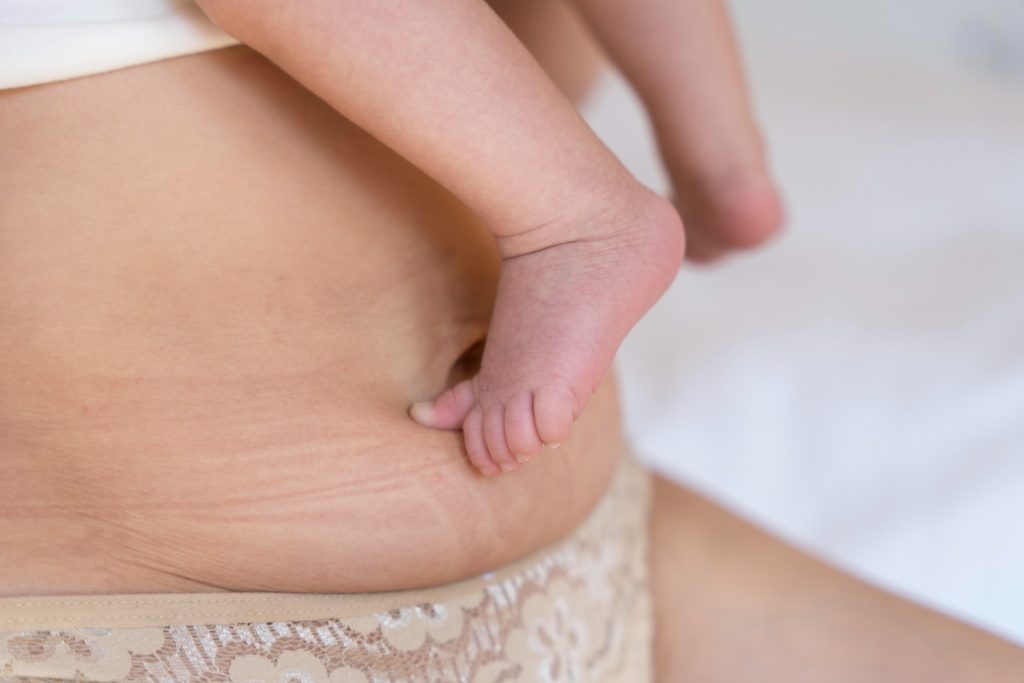 Relâchement de la peau après la grossesse